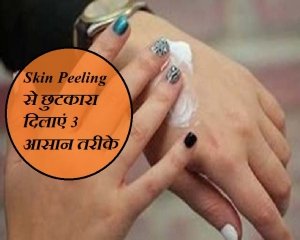 नहीं निकलेगी हाथ-पैरों की त्‍वचा, आजमाएं 3 आसान तरीके