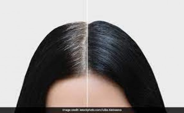 युवाओं में बढ़ रही है White hair की परेशानी, इन उपायों को अपनाने से मिल सकता है निजात
