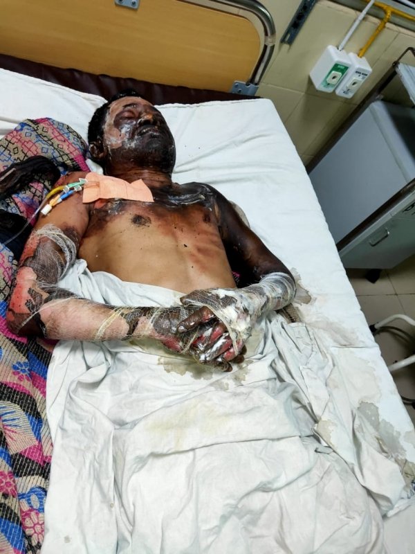 जिनके कारण युवक ने अपने आपको लगाईं थी आग उन्हें करे पुलिस गिरफ्तार क्युकी अब नहीं रहा इस दुनिया में युवक दुकानदार -- जनता कांग्रेस छत्तीसगढ़ जे पार्टी