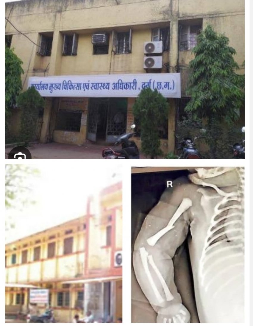 दुर्ग जिला अस्पताल में लापरवाही पर कब गिरेगी गाज? नवजात की टूटी हड्डियां, जिम्मेदारों पर कार्रवाई अब भी सवालों में!
