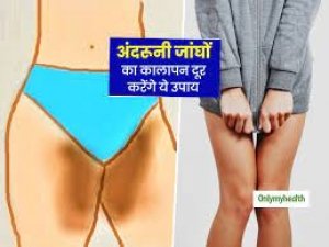 Thigh का कालापन कैसे करें दूर, जानिए आसान तरीके