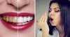 मुंह खोलते ही आती है बुरी बदबू तो आज ही आजमा लें ये 6 तरीके, Bad Breath हो जाएगी झट से दूर 